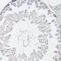 ABCC4 Rabbit Polyclonal Antibody