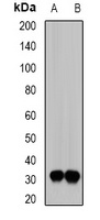SIAH1 Rabbit Polyclonal Antibody