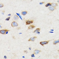 SIAH1 Rabbit Polyclonal Antibody