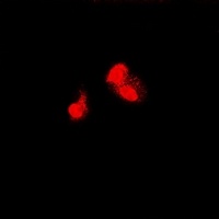 SIAH1 Rabbit Polyclonal Antibody