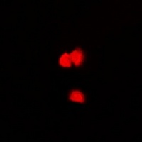 CASK Rabbit Polyclonal Antibody