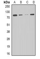 CPT2 Rabbit Polyclonal Antibody