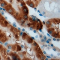 CPT2 Rabbit Polyclonal Antibody