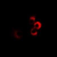 CPT2 Rabbit Polyclonal Antibody