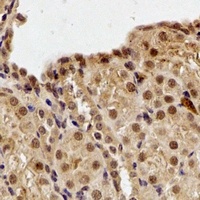 DDB1 Rabbit Polyclonal Antibody