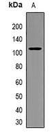 PIBF Rabbit Polyclonal Antibody