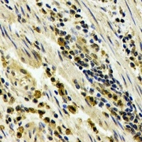 STAU1 Rabbit Polyclonal Antibody