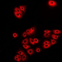 Atlastin-1 Rabbit Polyclonal Antibody