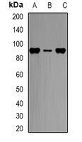 CPT1A Rabbit Polyclonal Antibody
