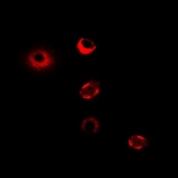 CPT1A Rabbit Polyclonal Antibody