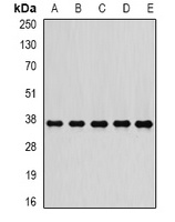 PSMD7 Rabbit Polyclonal Antibody