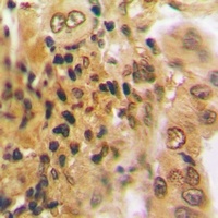 PSMD7 Rabbit Polyclonal Antibody