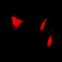 PSMD7 Rabbit Polyclonal Antibody