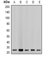CHMP2B Antibody