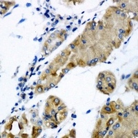 CHMP2B Antibody