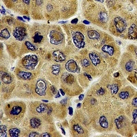DLD Rabbit Polyclonal Antibody