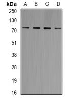 GlyRS Rabbit Polyclonal Antibody
