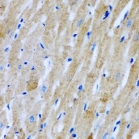 GlyRS Rabbit Polyclonal Antibody