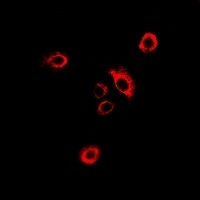 GlyRS Rabbit Polyclonal Antibody