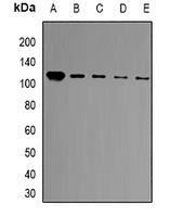 BCL11A Rabbit Polyclonal Antibody