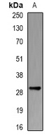 PSMB10 Rabbit Polyclonal Antibody