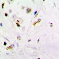 PSMB10 Rabbit Polyclonal Antibody