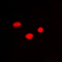 PSMB10 Rabbit Polyclonal Antibody