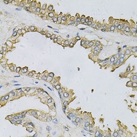 APRT Rabbit Polyclonal Antibody