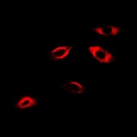 APRT Rabbit Polyclonal Antibody