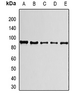 PRPF3 Rabbit Polyclonal Antibody
