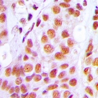 PRPF3 Rabbit Polyclonal Antibody
