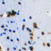 TLE1 Rabbit Polyclonal Antibody