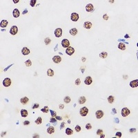 PRDM14 Antibody