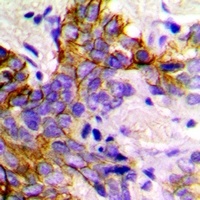 GABARAP Rabbit Polyclonal Antibody