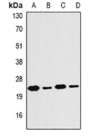 PSMB4 Rabbit Polyclonal Antibody