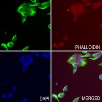 Bestrophin Rabbit Polyclonal Antibody