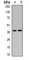 PCGF6 Rabbit Polyclonal Antibody