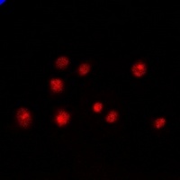 PCGF6 Rabbit Polyclonal Antibody
