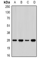 PHAP1 Rabbit Polyclonal Antibody