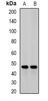 JMJD6 Rabbit Polyclonal Antibody