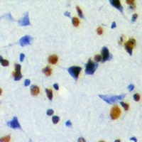 JMJD6 Rabbit Polyclonal Antibody