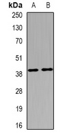 HuC Rabbit Polyclonal Antibody
