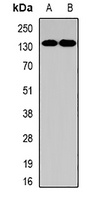 Pumilio 1 Rabbit Polyclonal Antibody