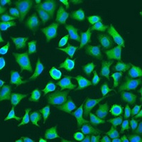 Pumilio 1 Rabbit Polyclonal Antibody