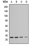 ESD Rabbit Polyclonal Antibody