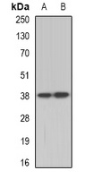 TEL2 Rabbit Polyclonal Antibody