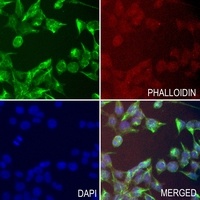 HSD17B13 Rabbit Polyclonal Antibody