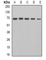 PDC-E2 Rabbit Polyclonal Antibody