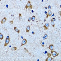 ArgRS Rabbit Polyclonal Antibody