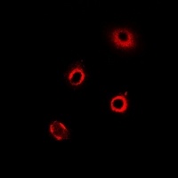 ArgRS Rabbit Polyclonal Antibody